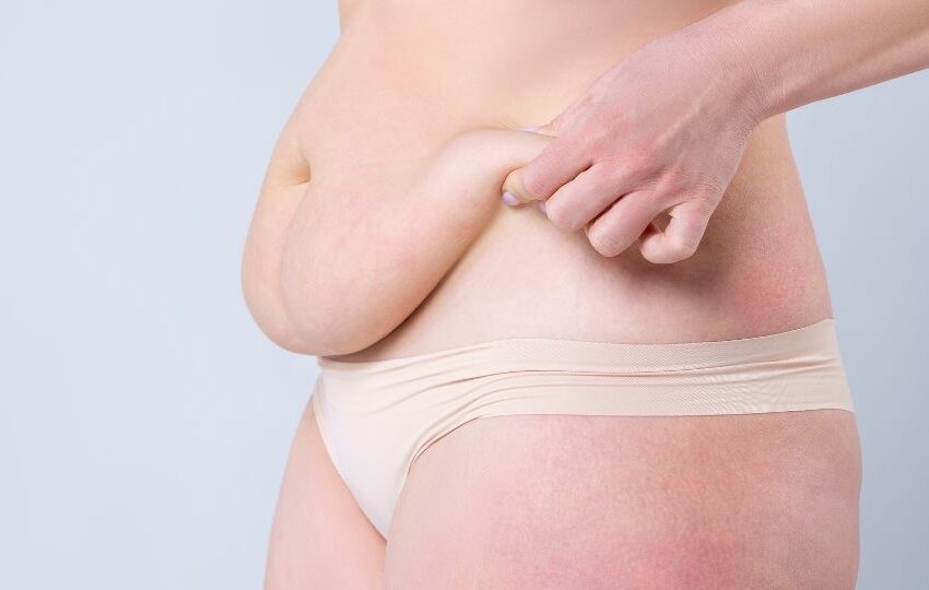  Apron Belly After Weight Loss: Causes & Best Fixes