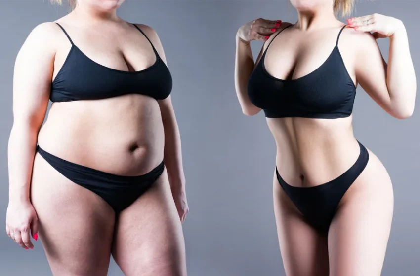  Weight Loss Surgery Before and After: Incredible Changes