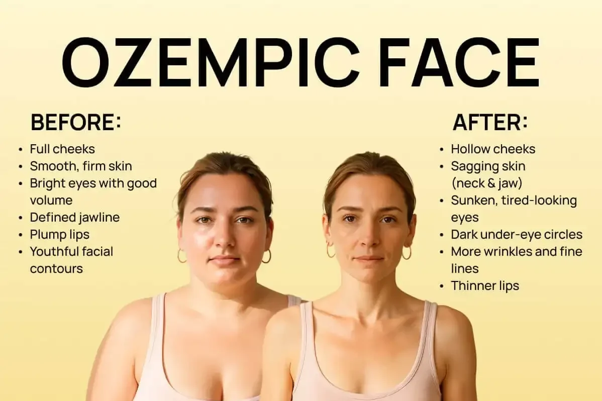 how to help ozempic face can you reverse ozempic face