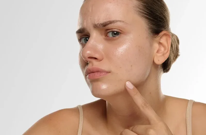  Best Skincare for Oily Skin: Expert Tips and Product Picks