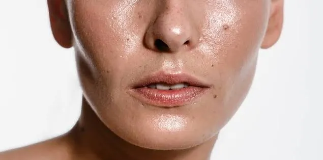 best skincare for oily skin