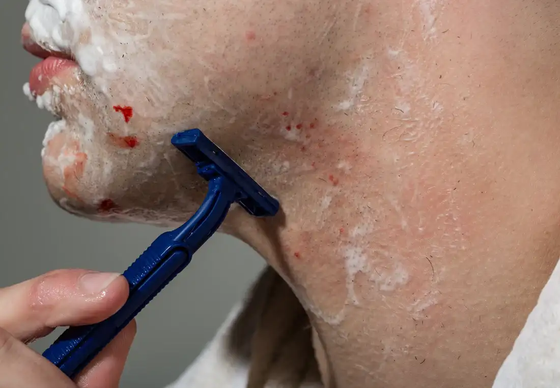 skincare for men