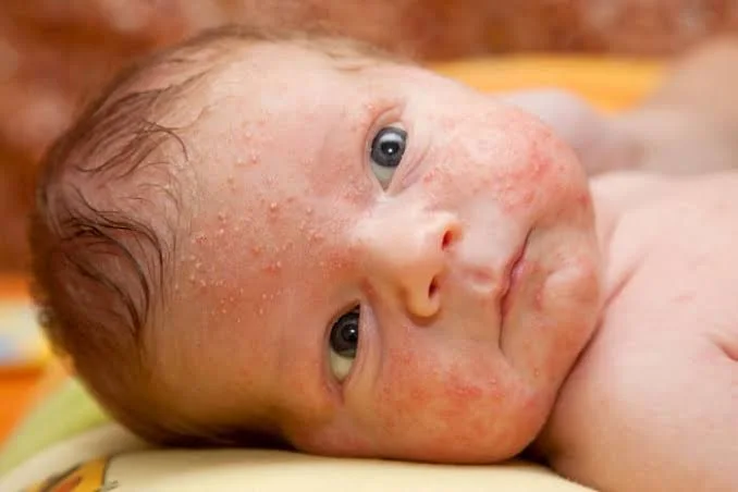 skincare for kids