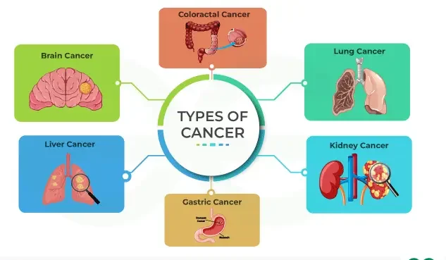 can immunotherapy cure stage 4 cancer