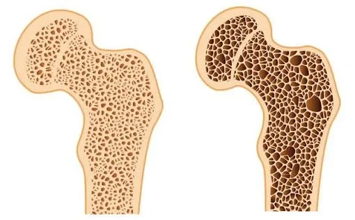 female reproductive hormones