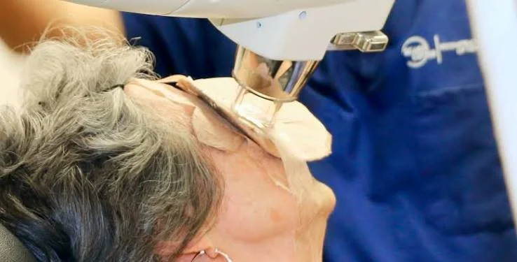 melanoma on scalp