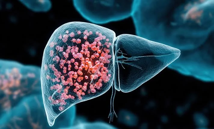 immunotherapy for liver cancer